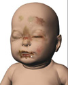 One of the pictures of Peters injuries.